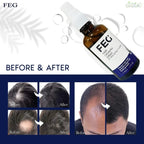 FEG Organic Hair Growth Treatment Oil